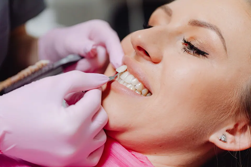 Illustration: Veneers oder Kronen: Welche Versorgung für welchen Zahn?